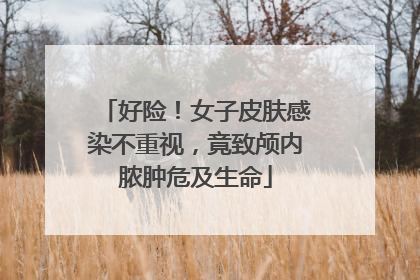 好险！女子皮肤感染不重视，竟致颅内脓肿危及生命